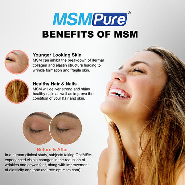Benefits of MSM on skin, hair & nails